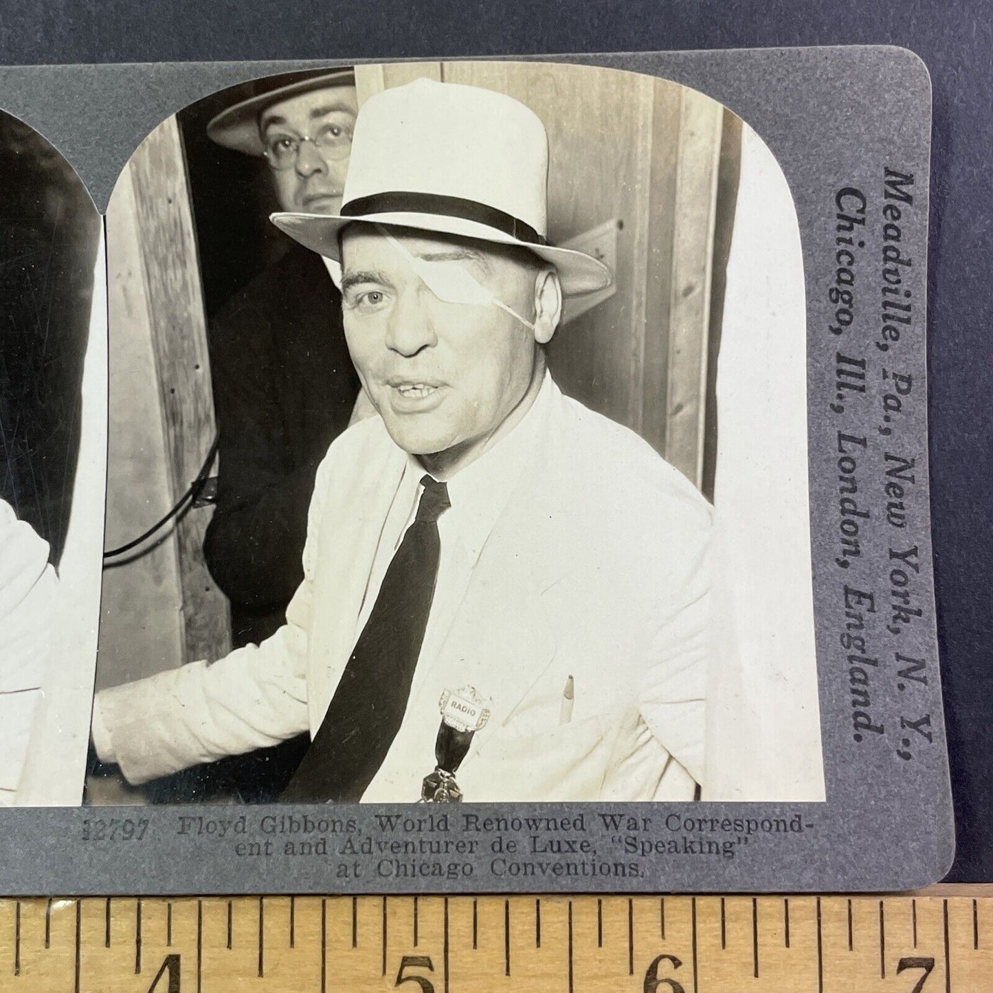 Man With Bullet Wound In Head Stereoview Shot In Eye Eyepatch Antique 1920s X830