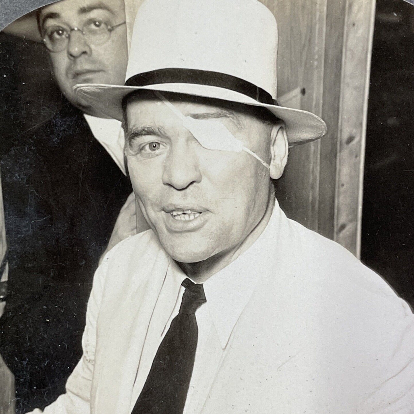 Man With Bullet Wound In Head Stereoview Shot In Eye Eyepatch Antique 1920s X830