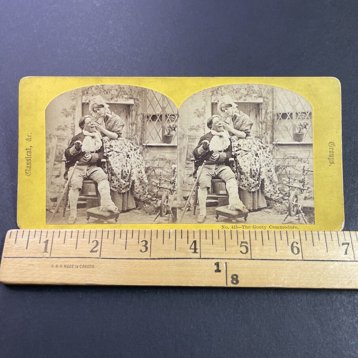Antique 1870s Woman Treats A Man's Pimple Stereoview Photo Card P3974