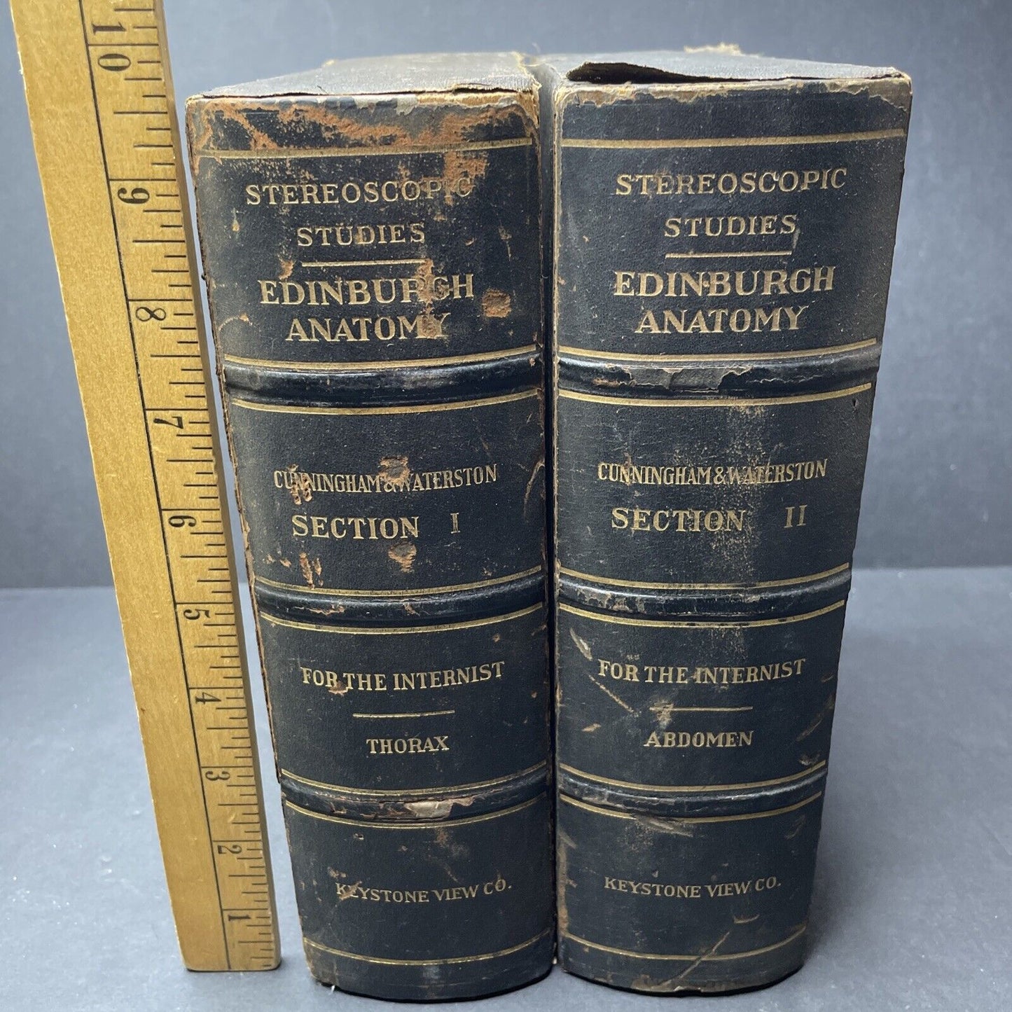 Internal Medicine Anatomy Stereoview 80pc Set Surgical Autopsy Antique 1911