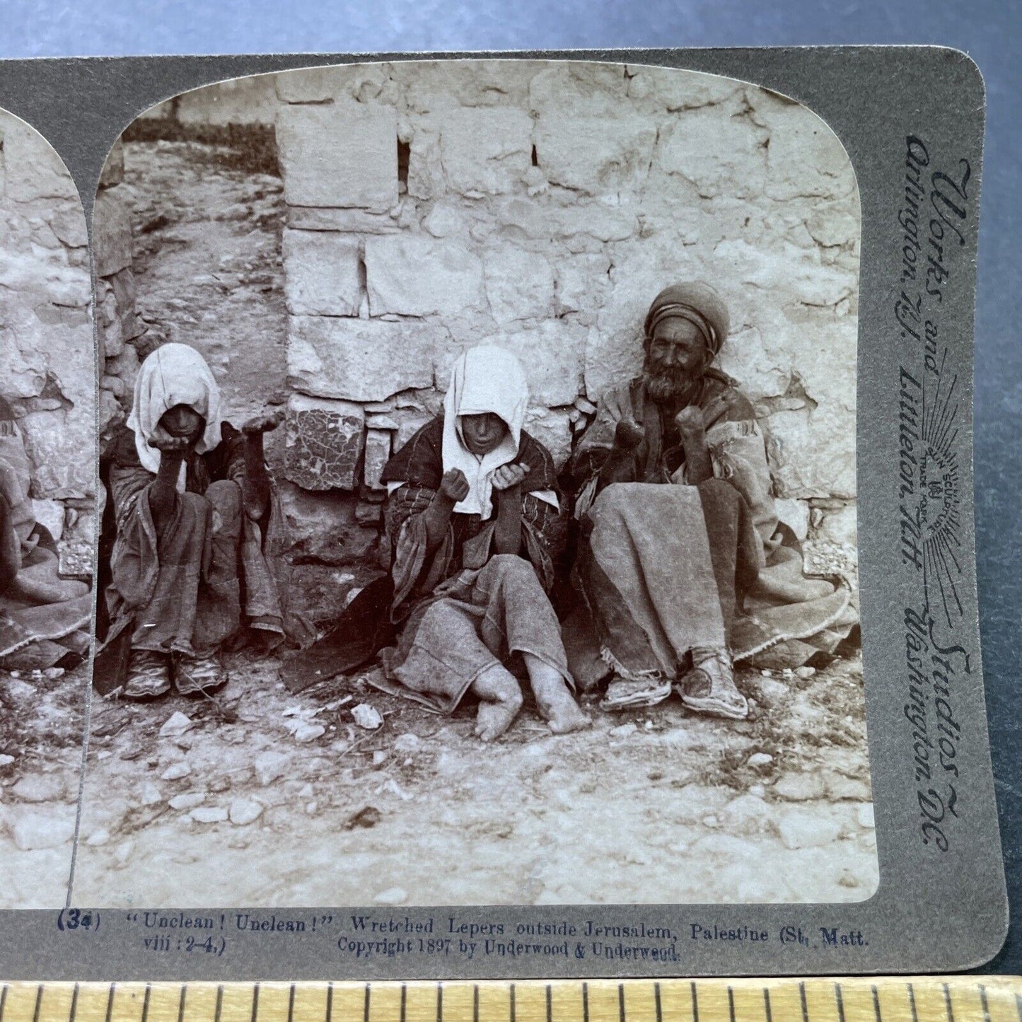 Antique 1897 Beggars Have Lost Their Limbs Leprosy Stereoview Photo Card P1981
