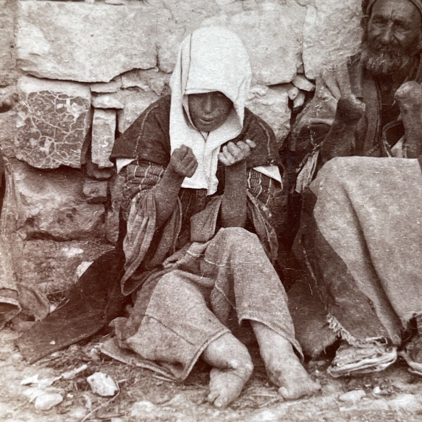 Antique 1897 Beggars Have Lost Their Limbs Leprosy Stereoview Photo Card P1981