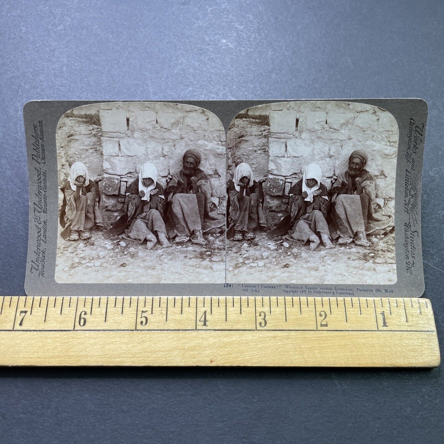 Antique 1897 Beggars Have Lost Their Limbs Leprosy Stereoview Photo Card P1981