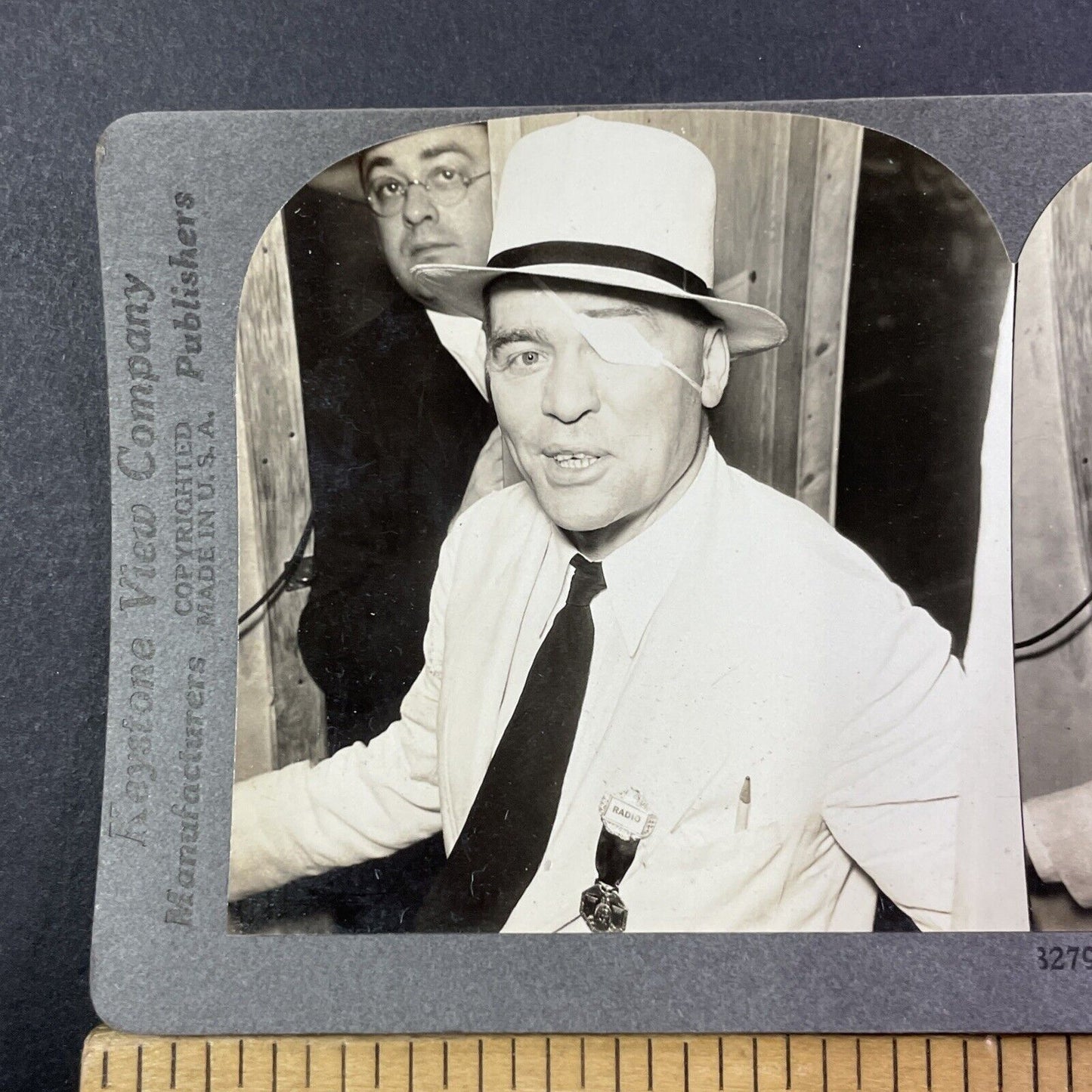 Man With Bullet Wound In Head Stereoview Shot In Eye Eyepatch Antique 1920s X830