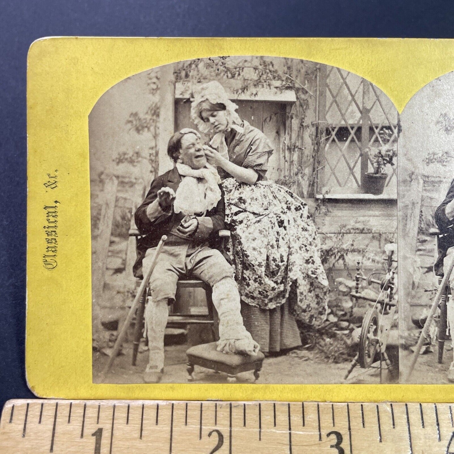 Antique 1870s Woman Treats A Man's Pimple Stereoview Photo Card P3974