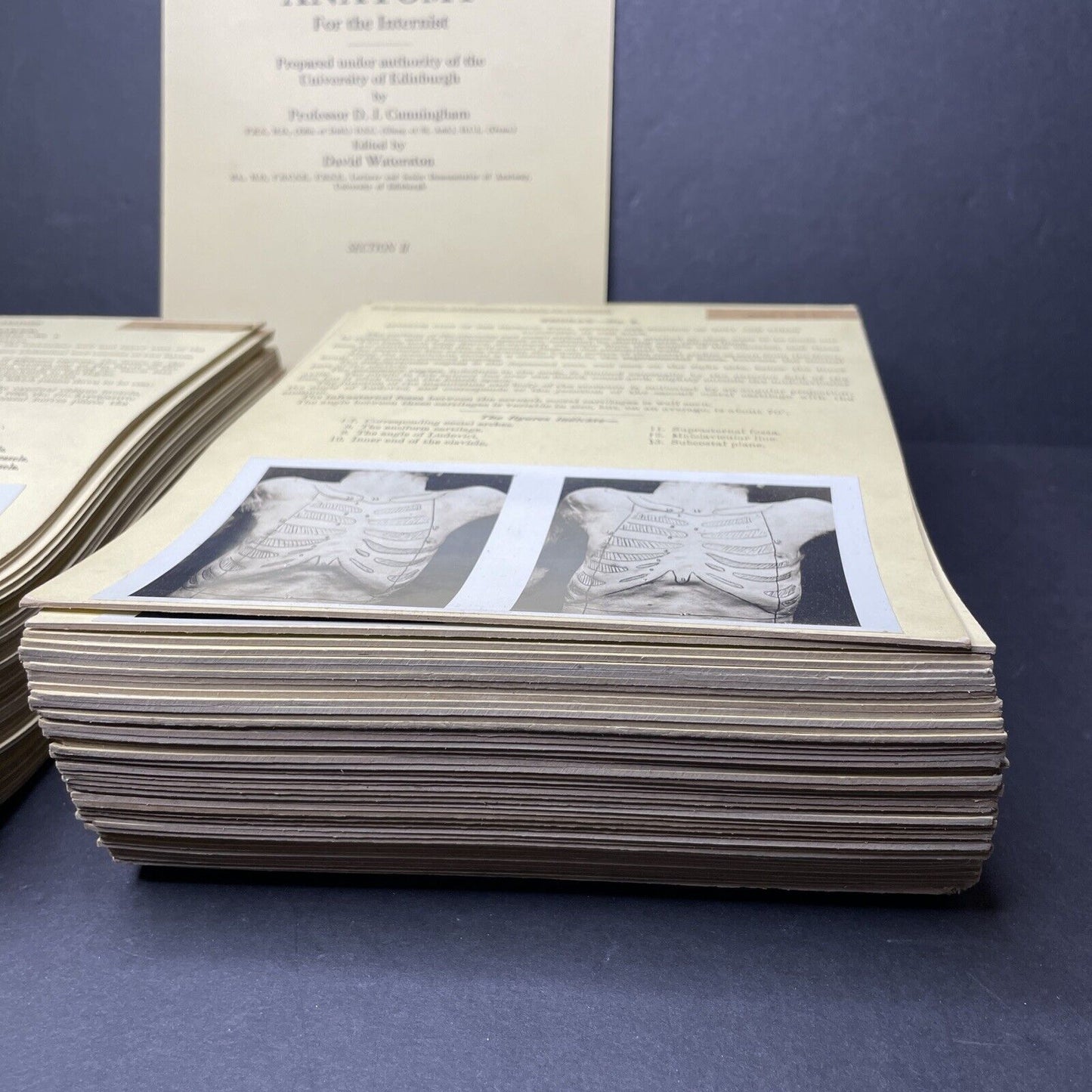 Internal Medicine Anatomy Stereoview 80pc Set Surgical Autopsy Antique 1911
