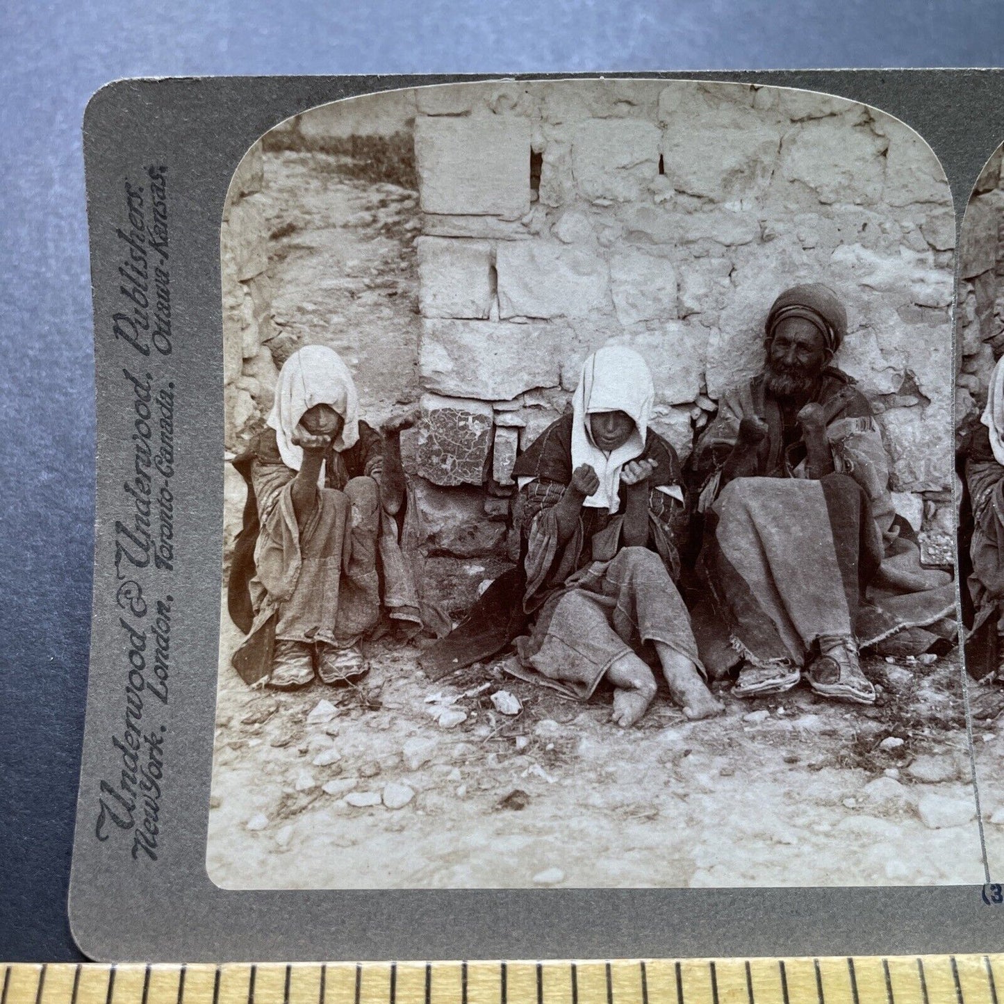 Antique 1897 Beggars Have Lost Their Limbs Leprosy Stereoview Photo Card P1981