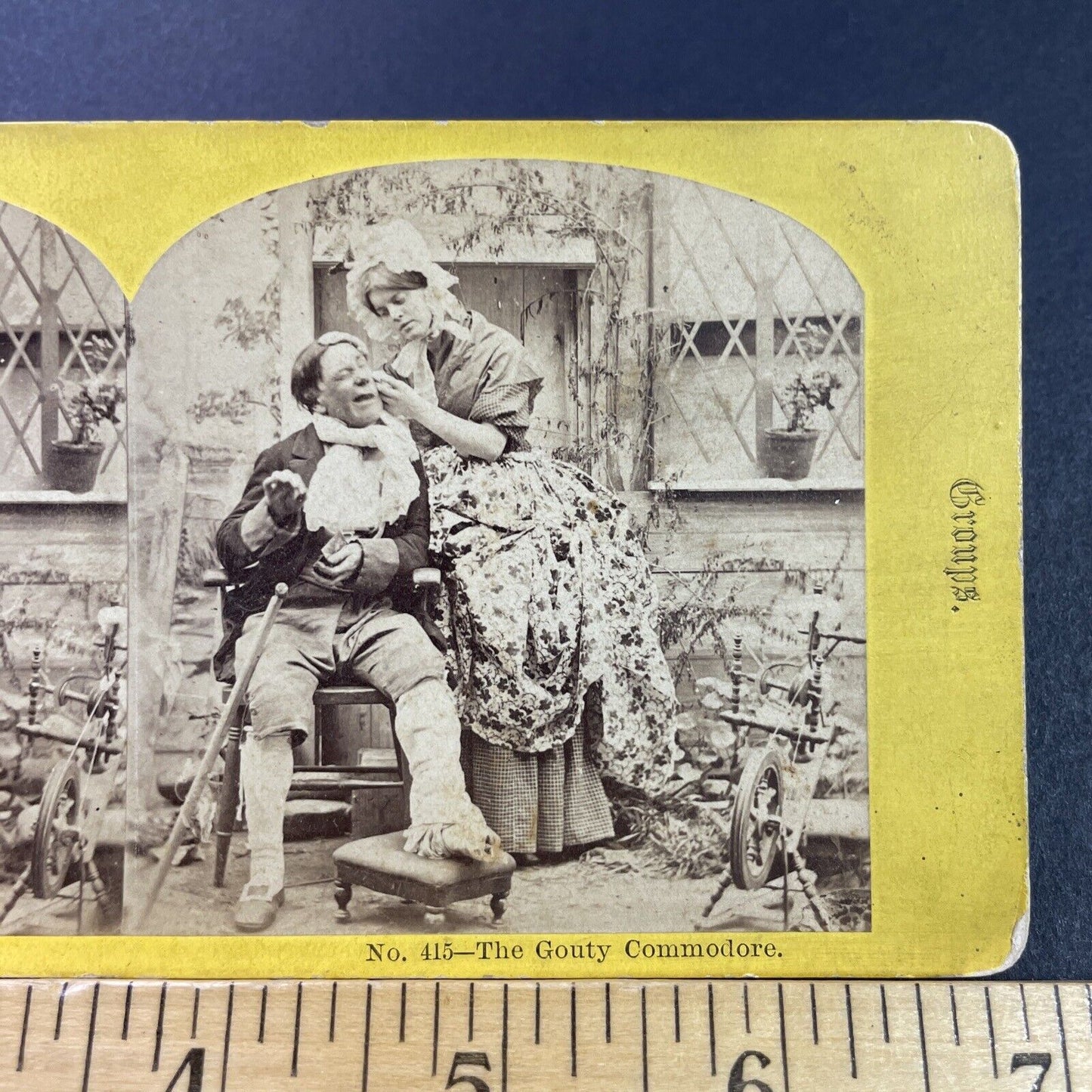 Antique 1870s Woman Treats A Man's Pimple Stereoview Photo Card P3974