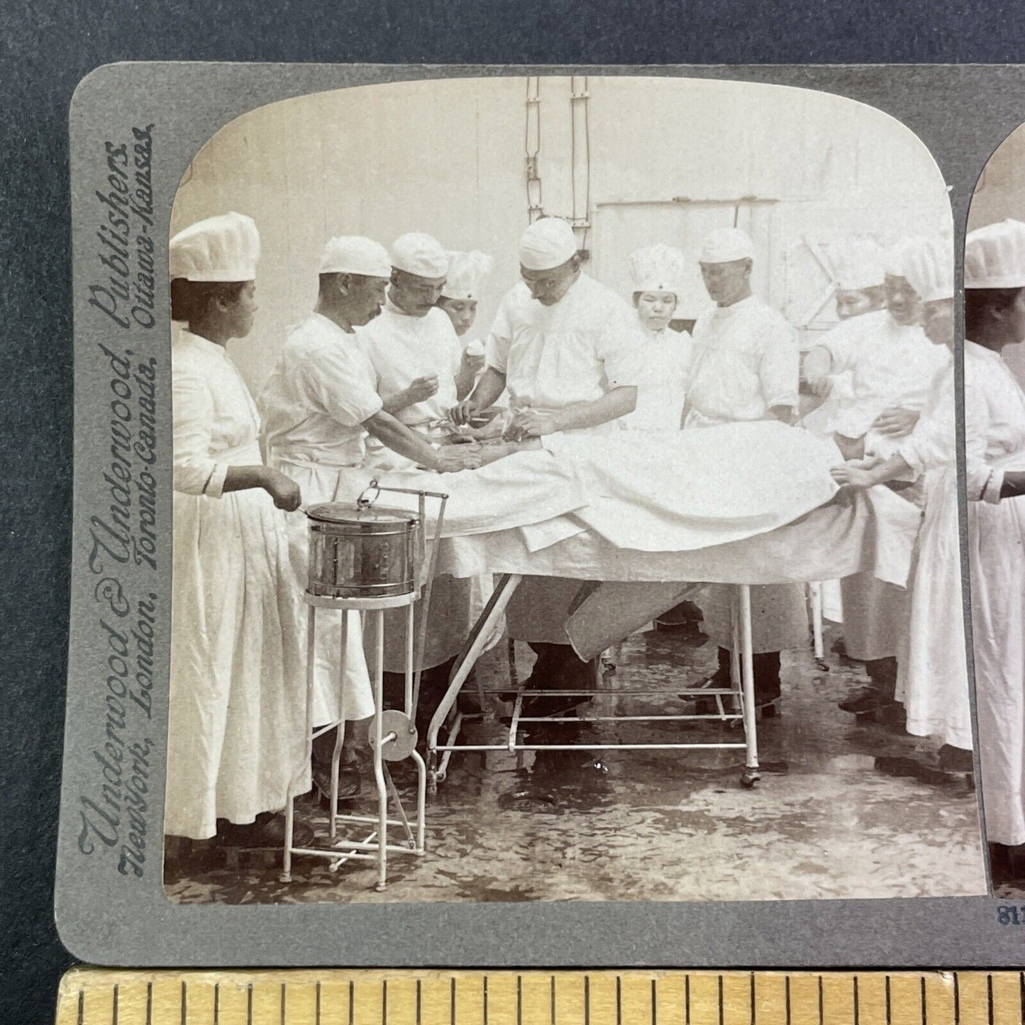 Surgeons Surgery On Patient In Japan Hospital Stereoview Antique c1905 X3119