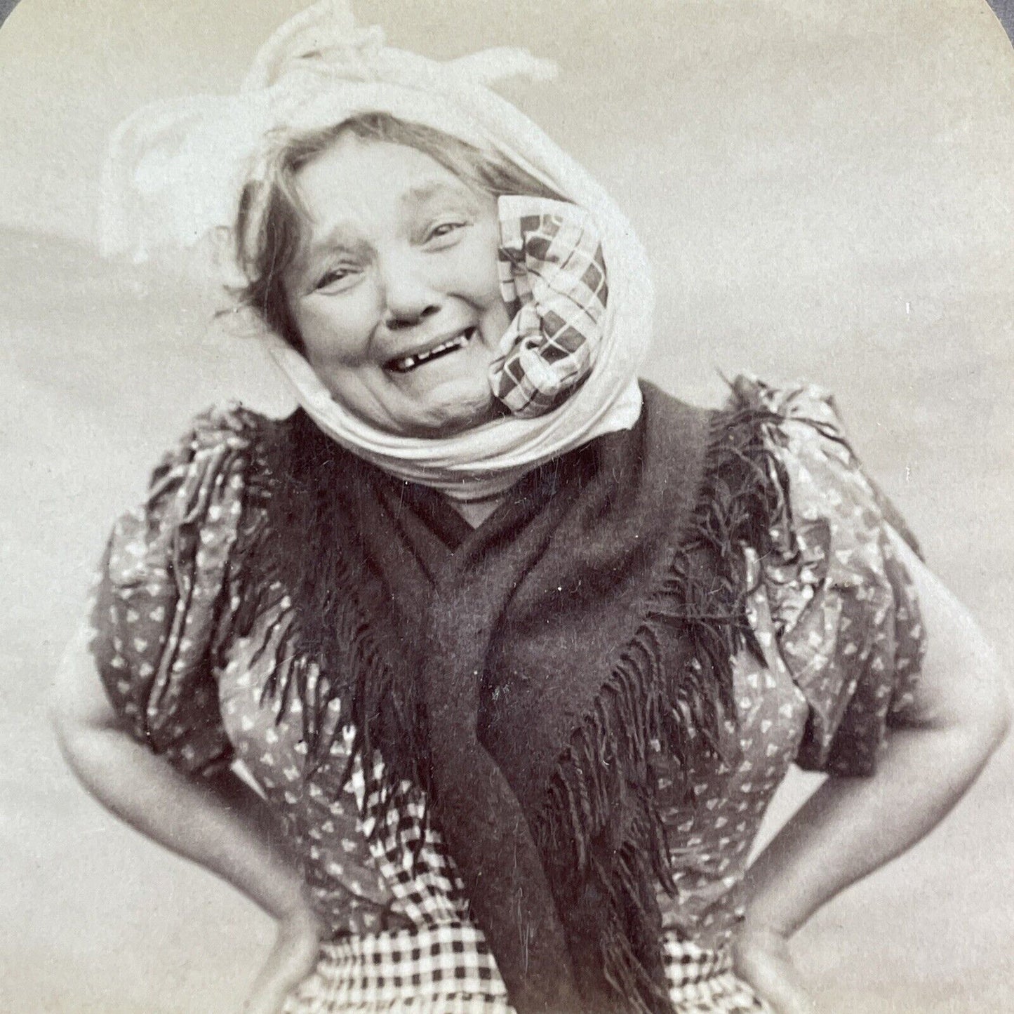 Woman with a Toothache sees a Dentist Stereoview Antique c1901 Y1234