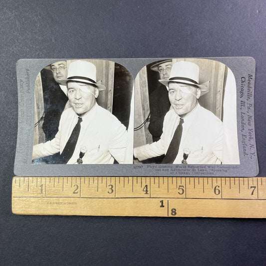 Man With Bullet Wound In Head Stereoview Shot In Eye Eyepatch Antique 1920s X830