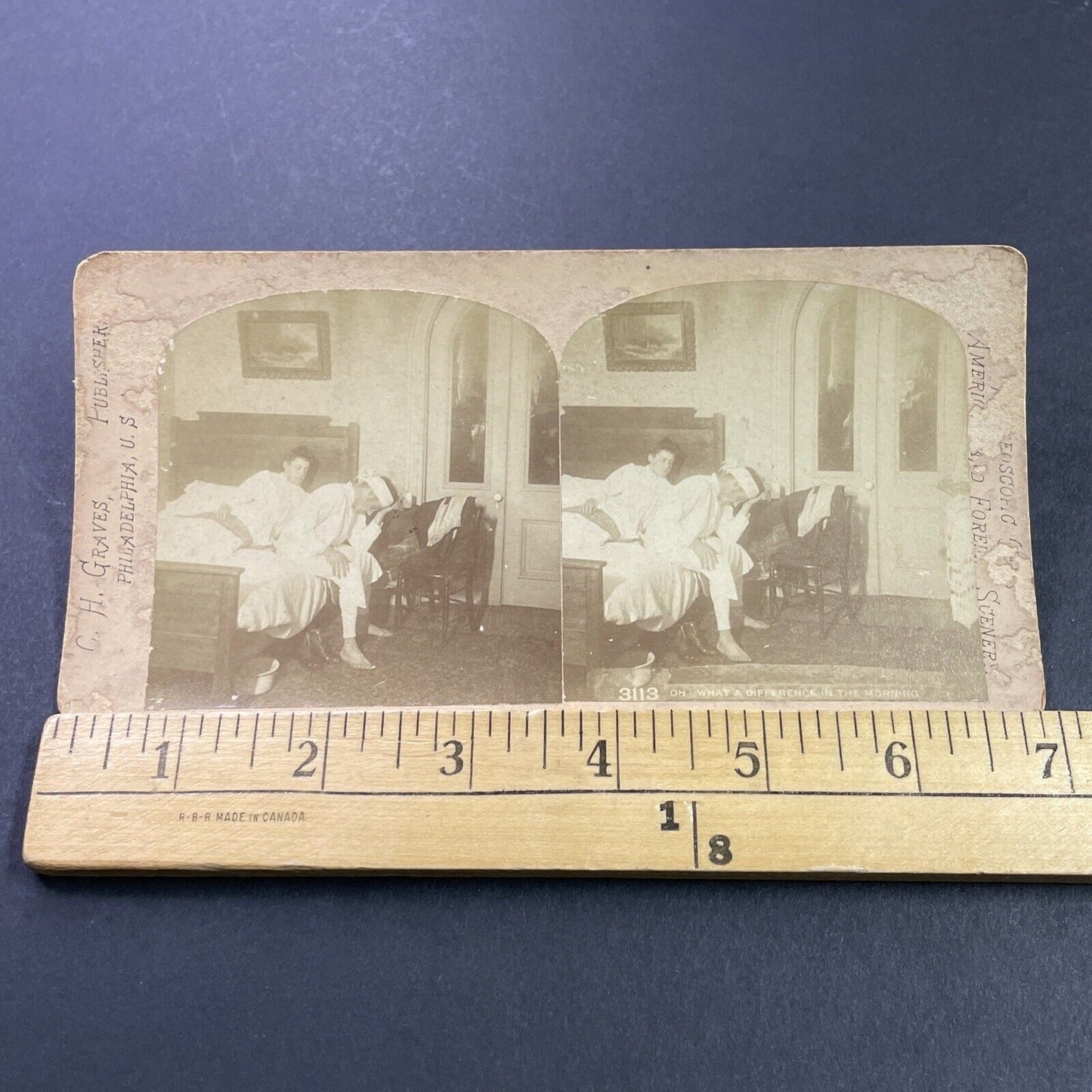 Antique 1880s Drunk Man With Hangover Stereoview Photo Card P3961