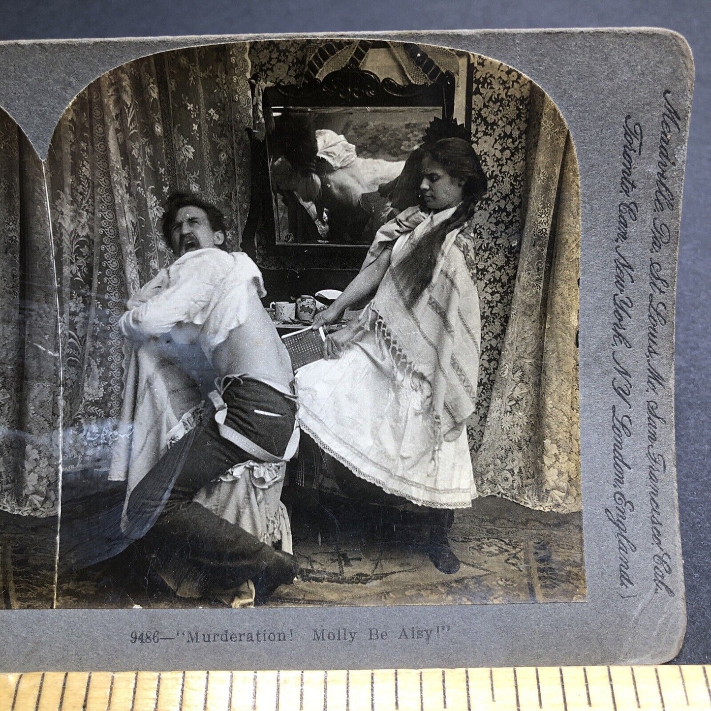 Antique 1899 Back Waxing Man Screaming In Pain  Stereoview Photo Card P1984