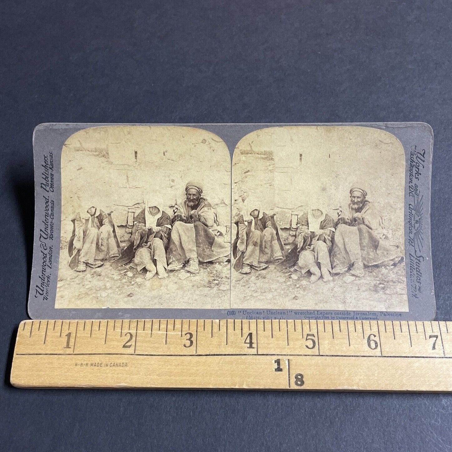 Antique 1896 Lost Limbs To Leprosy Beggars Lepers Stereoview Photo Card P4206