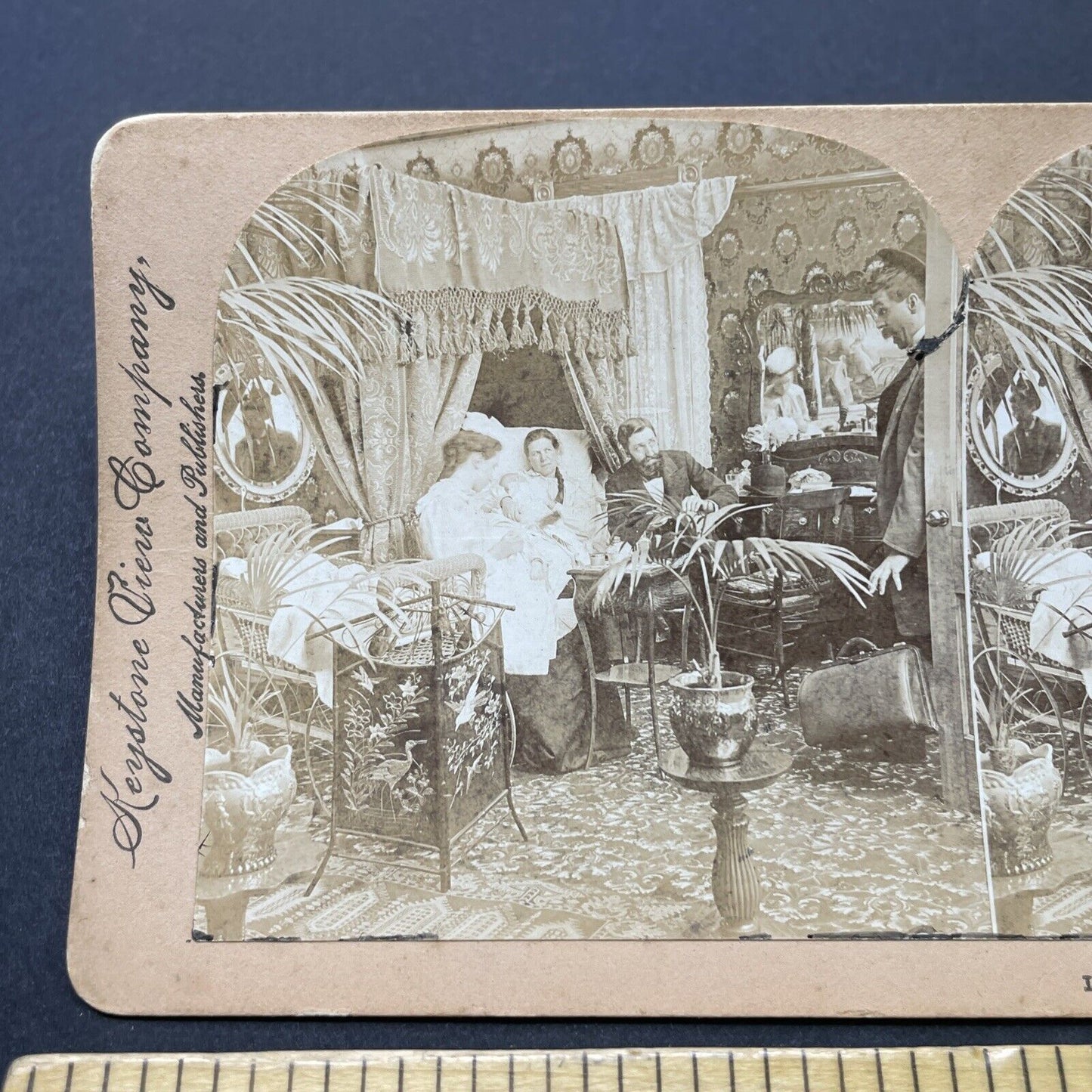 Antique 1900 Doctor Delivers Twins Twin Babies Stereoview Photo Card P2552