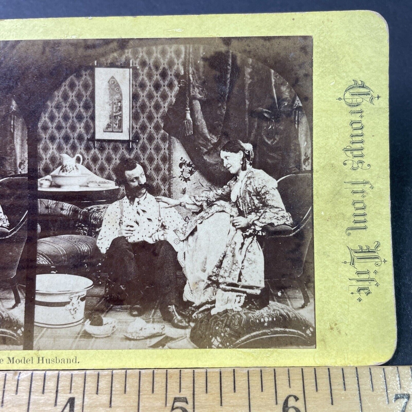 Antique 1880s Man Files Womans Toe Nails Toenails Stereoview Photo Card P3006