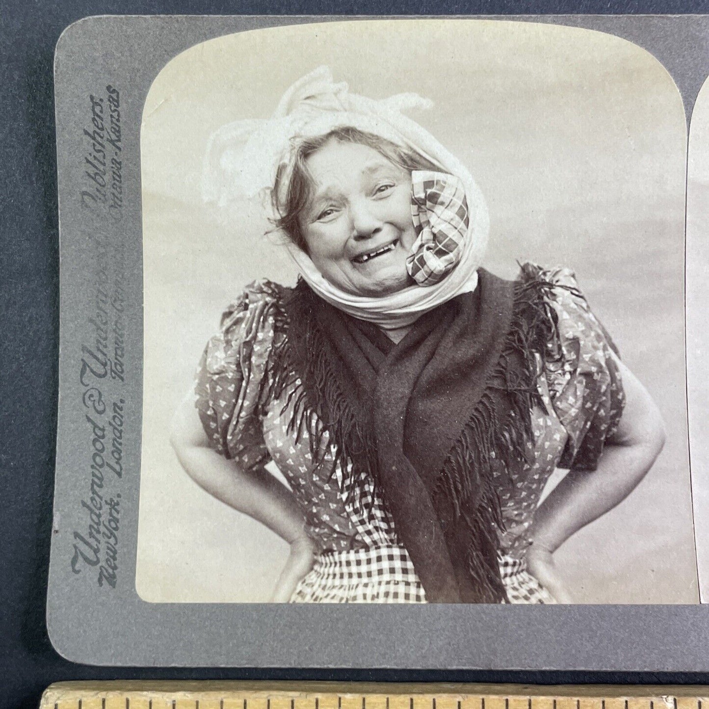 Woman with a Toothache sees a Dentist Stereoview Antique c1901 Y1234