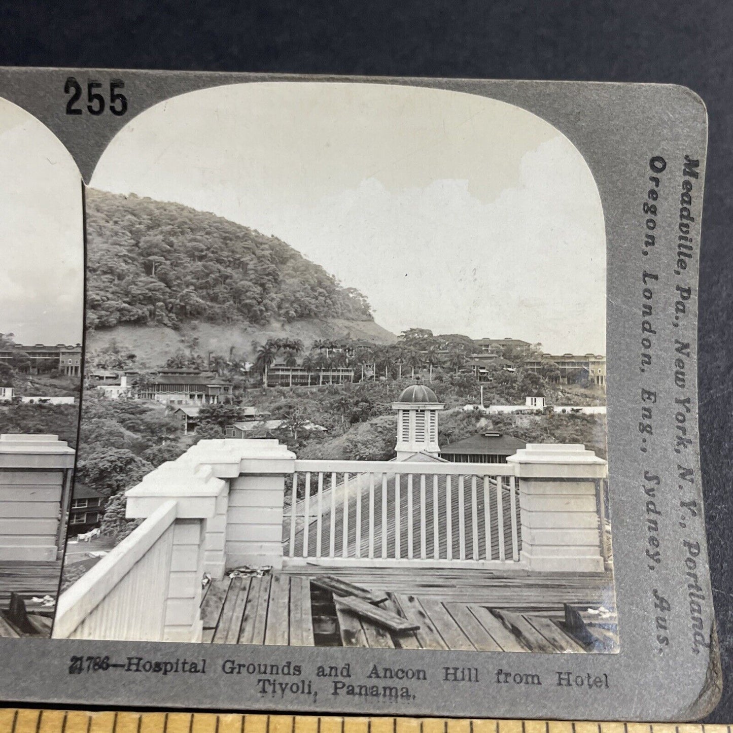 Antique 1910s Construction Worker Hospital Panama Stereoview Photo Card P4458