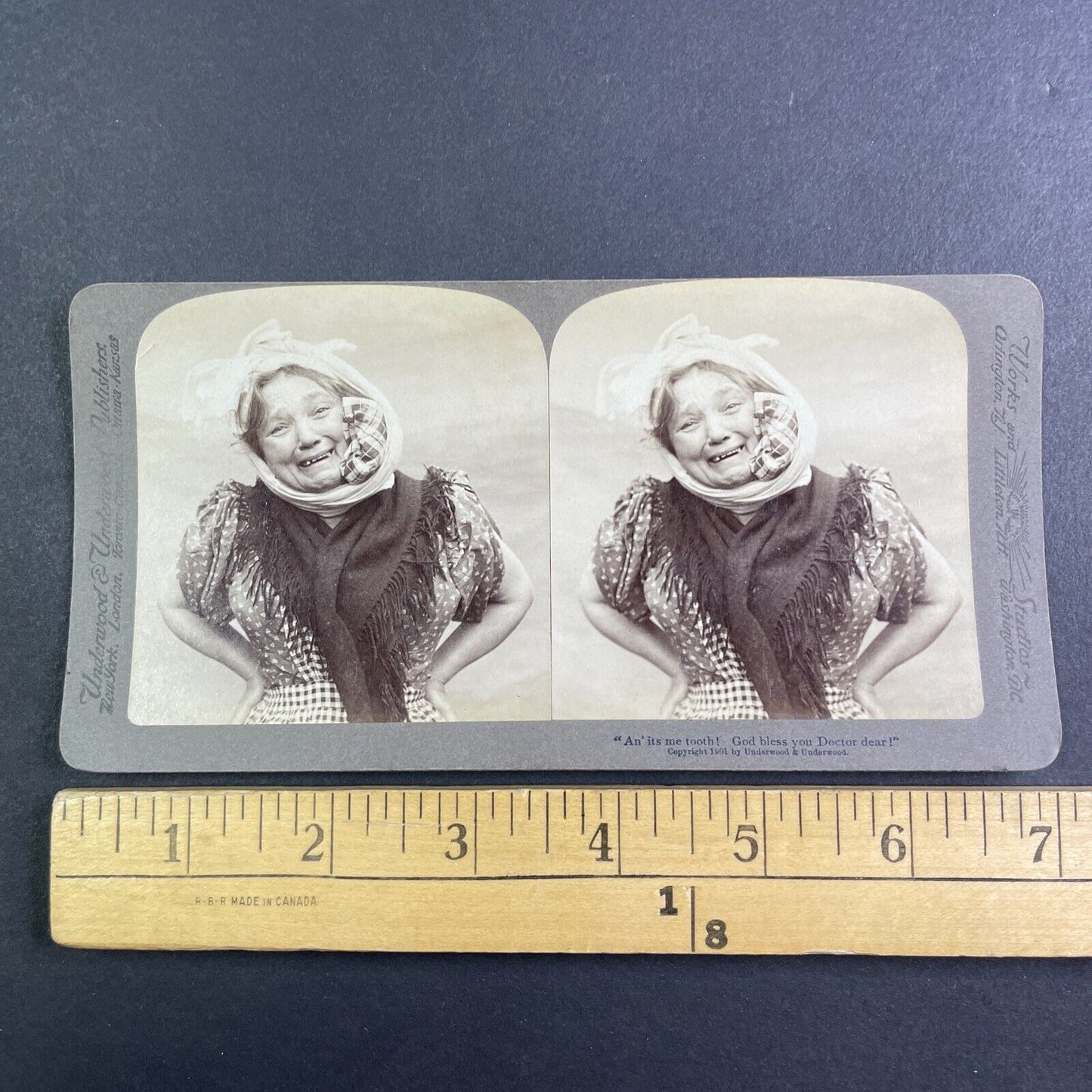 Woman with a Toothache sees a Dentist Stereoview Antique c1901 Y1234