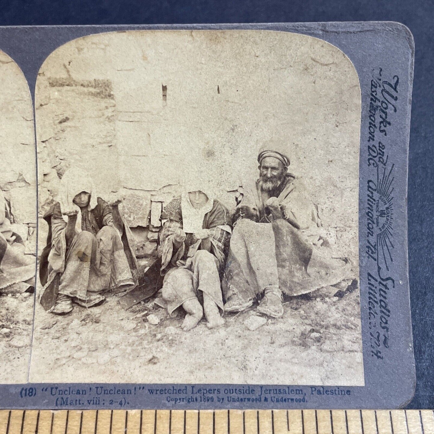 Antique 1896 Lost Limbs To Leprosy Beggars Lepers Stereoview Photo Card P4206