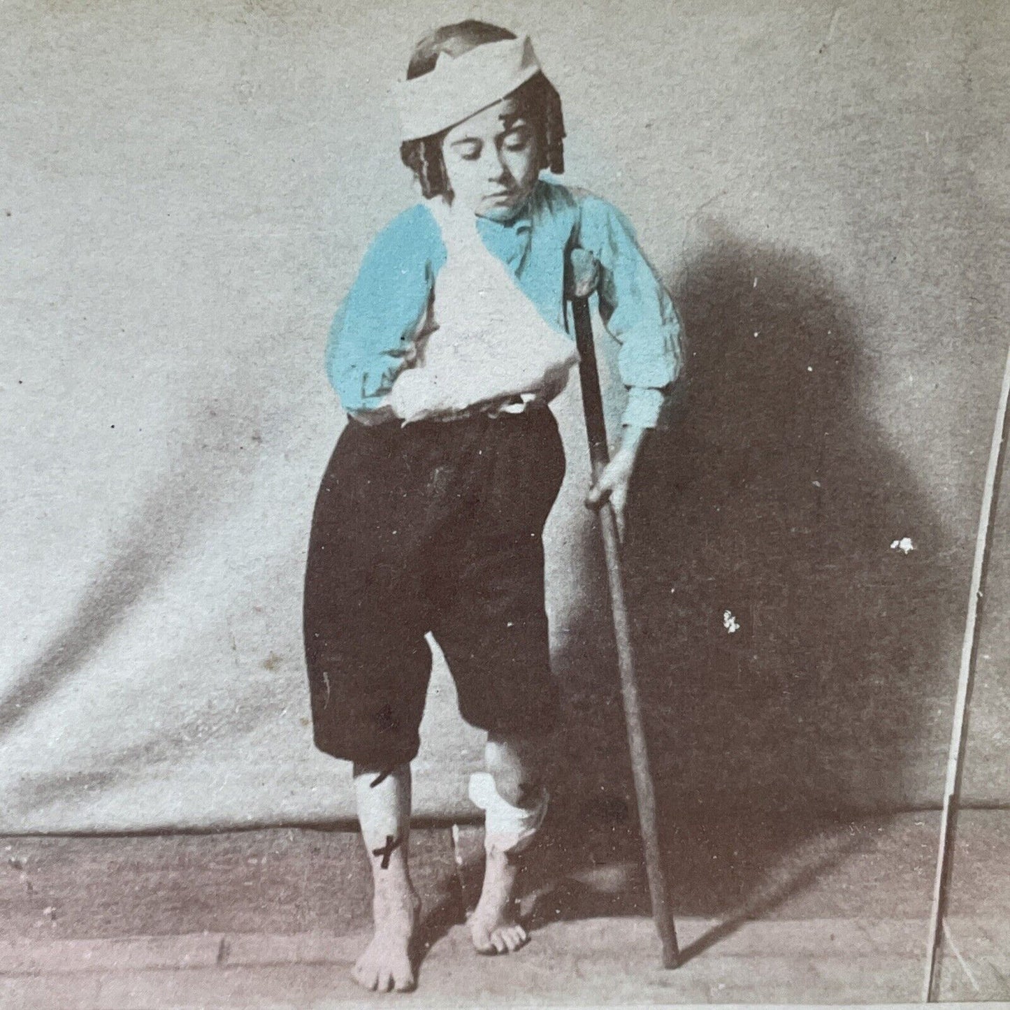 Antique 1880s Boy Injured By 4th Of July Gunpowder Stereoview Photo Card V3293
