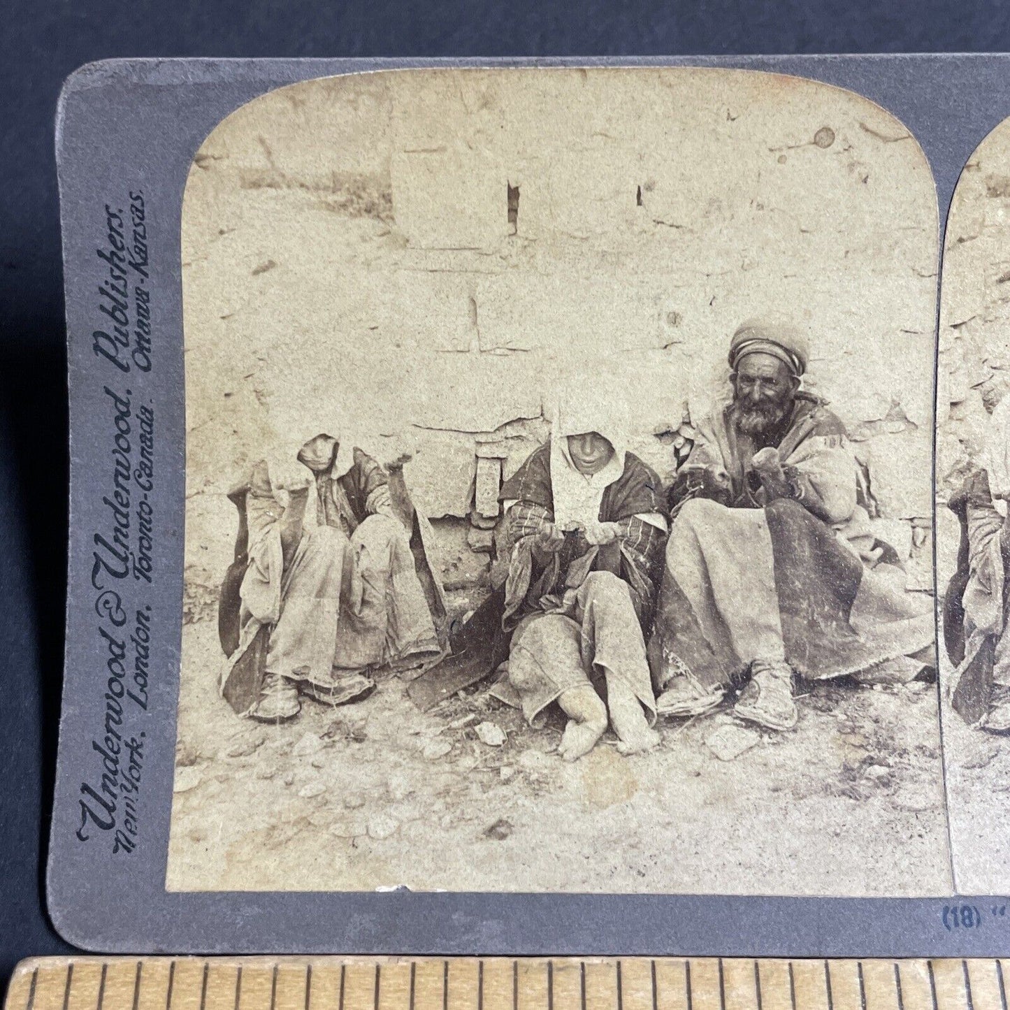 Antique 1896 Lost Limbs To Leprosy Beggars Lepers Stereoview Photo Card P4206