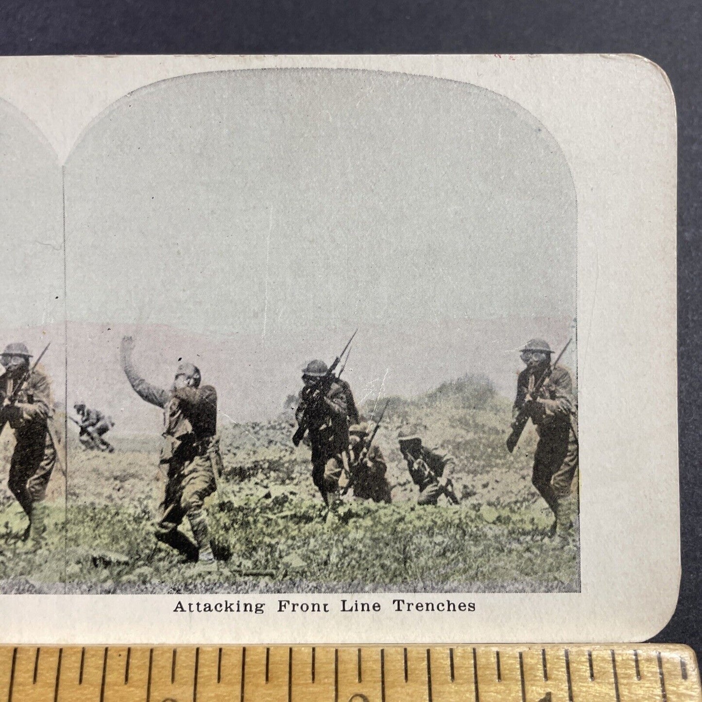 Antique 1915 British Soldier Is Shot In The Neck WW1 Stereoview Photo Card Q2245