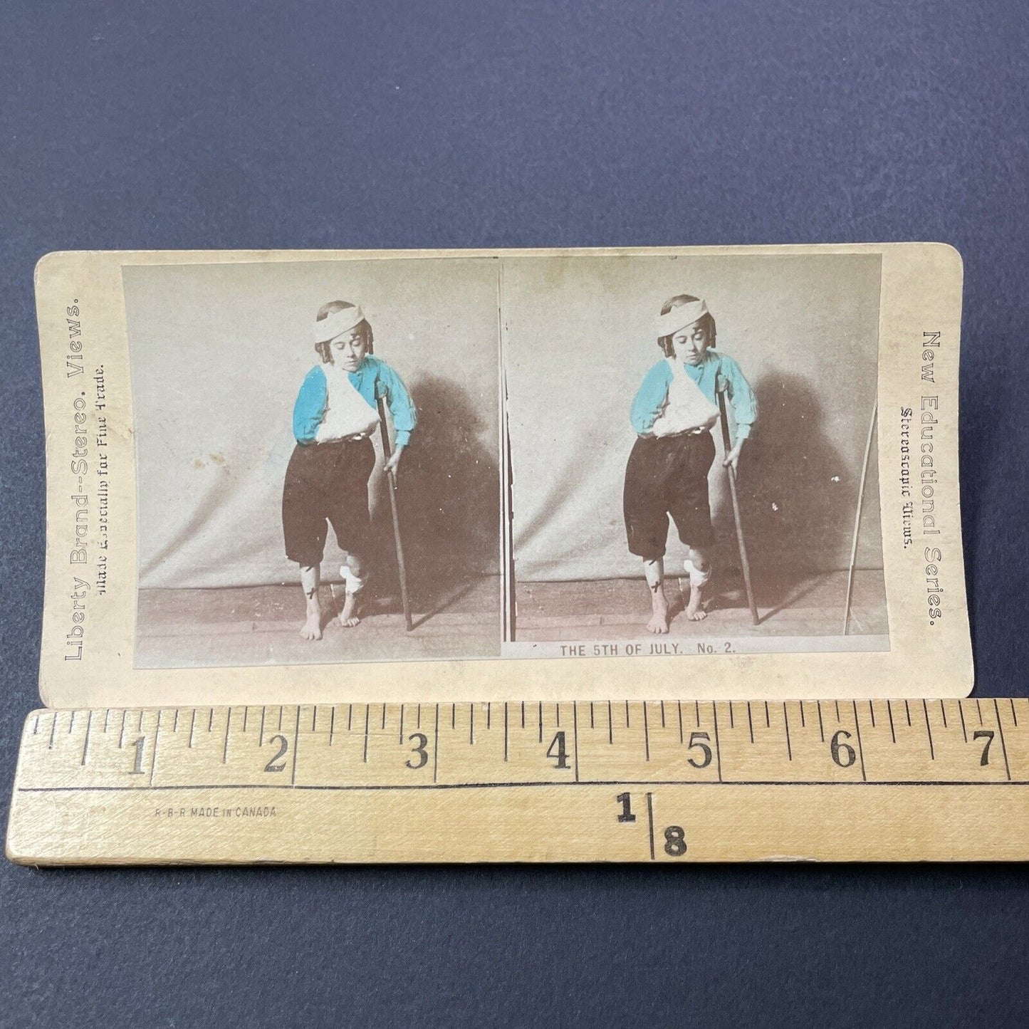 Antique 1880s Boy Injured By 4th Of July Gunpowder Stereoview Photo Card V3293