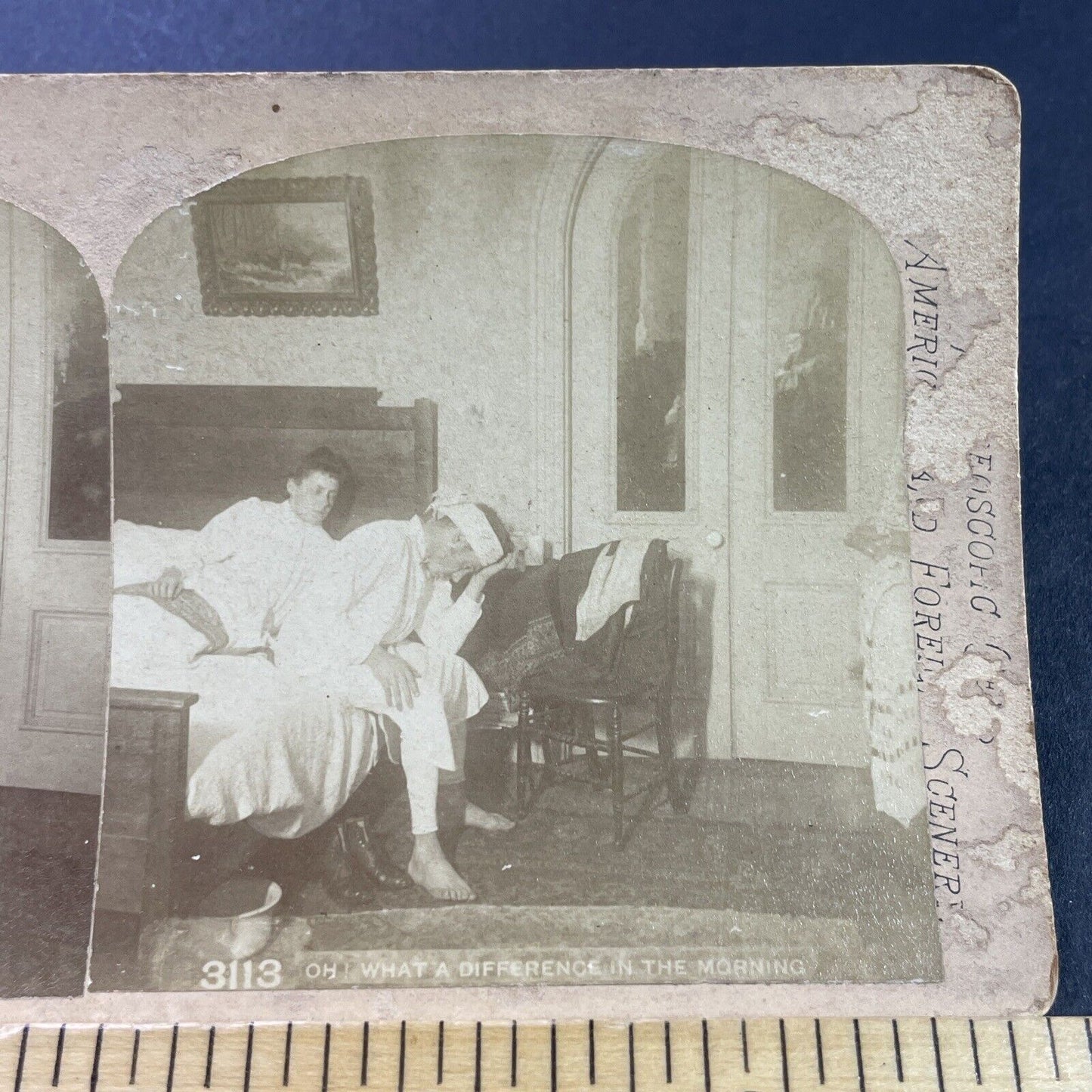 Antique 1880s Drunk Man With Hangover Stereoview Photo Card P3961