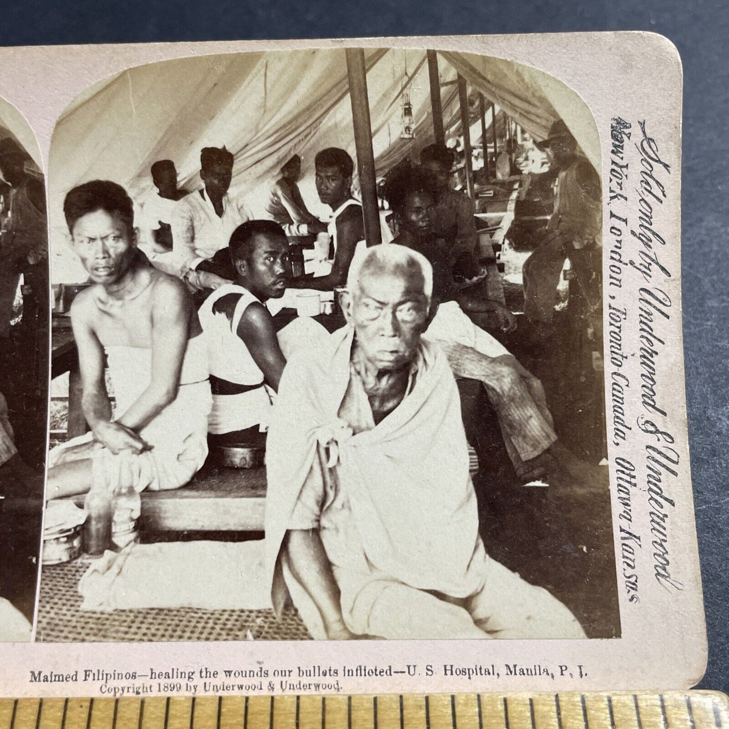 Antique 1899 Injured Philippines Army Soldiers Stereoview Photo Card P5004