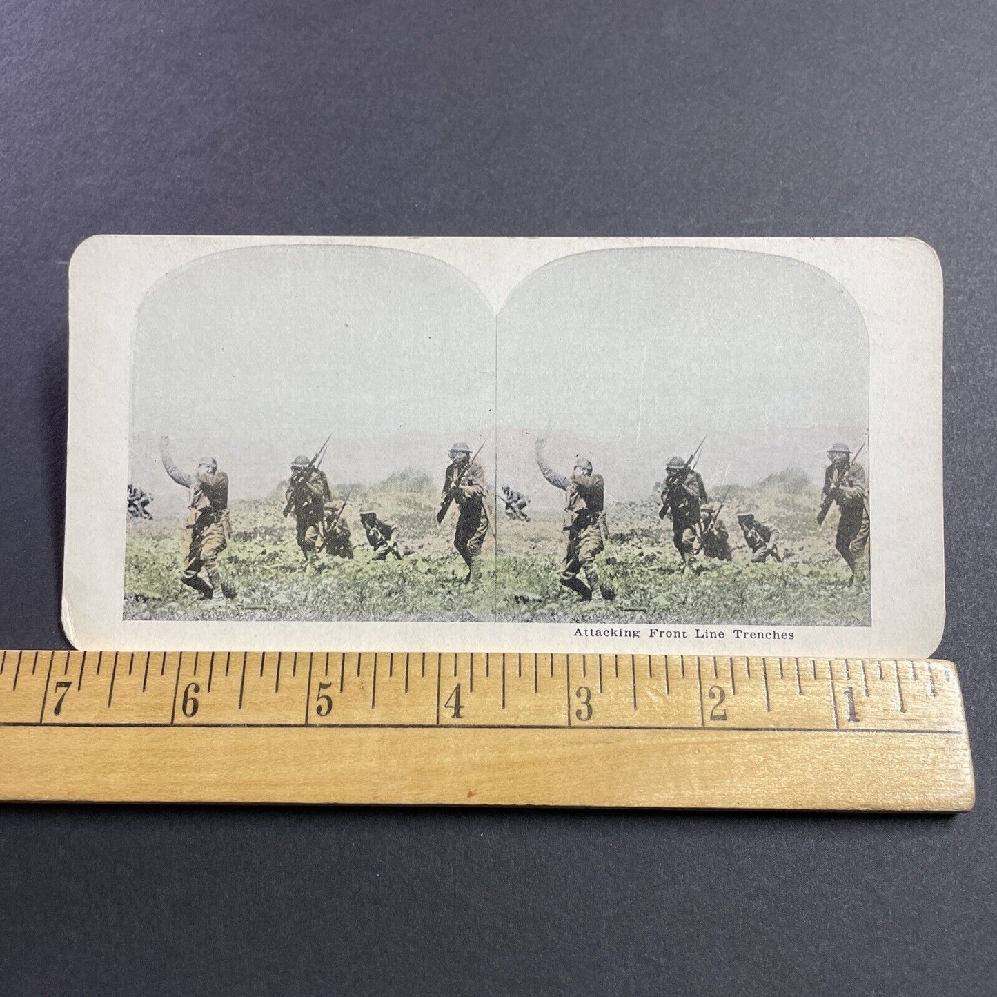 Antique 1915 British Soldier Is Shot In The Neck WW1 Stereoview Photo Card Q2245