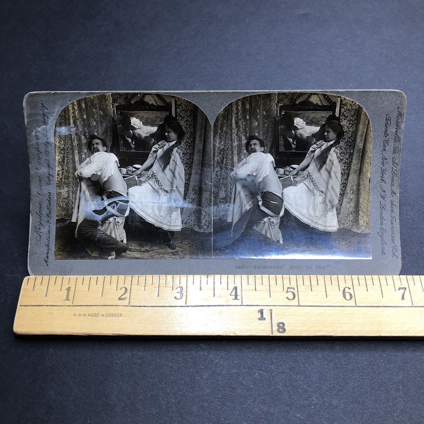 Antique 1899 Back Waxing Man Screaming In Pain  Stereoview Photo Card P1984