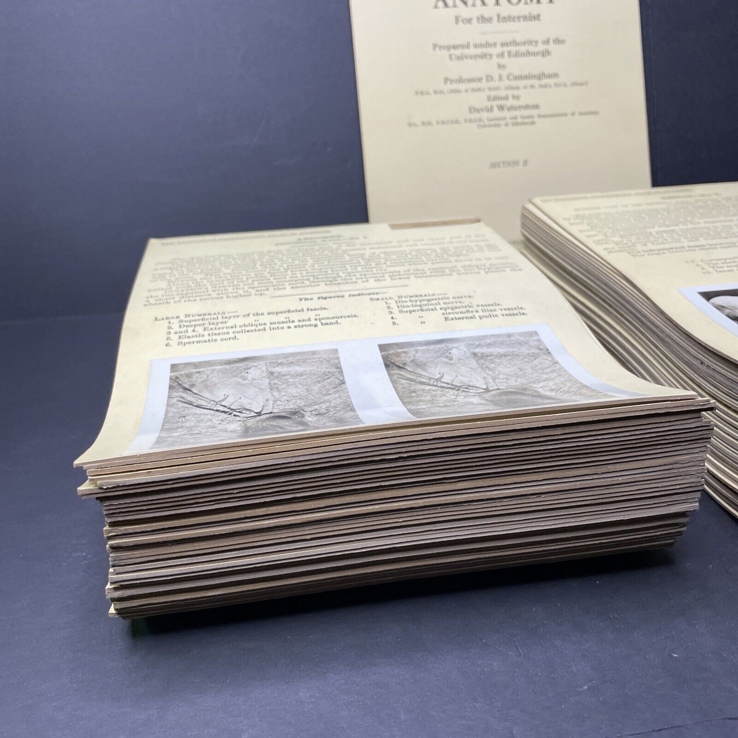 Internal Medicine Anatomy Stereoview 80pc Set Surgical Autopsy Antique 1911