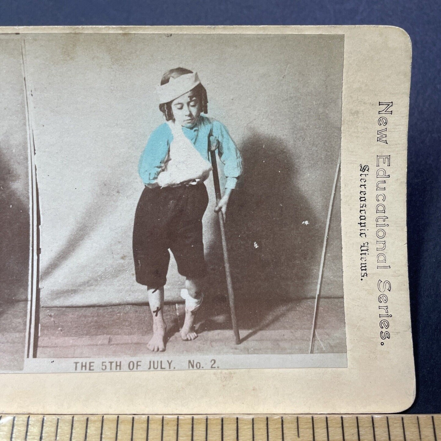 Antique 1880s Boy Injured By 4th Of July Gunpowder Stereoview Photo Card V3293